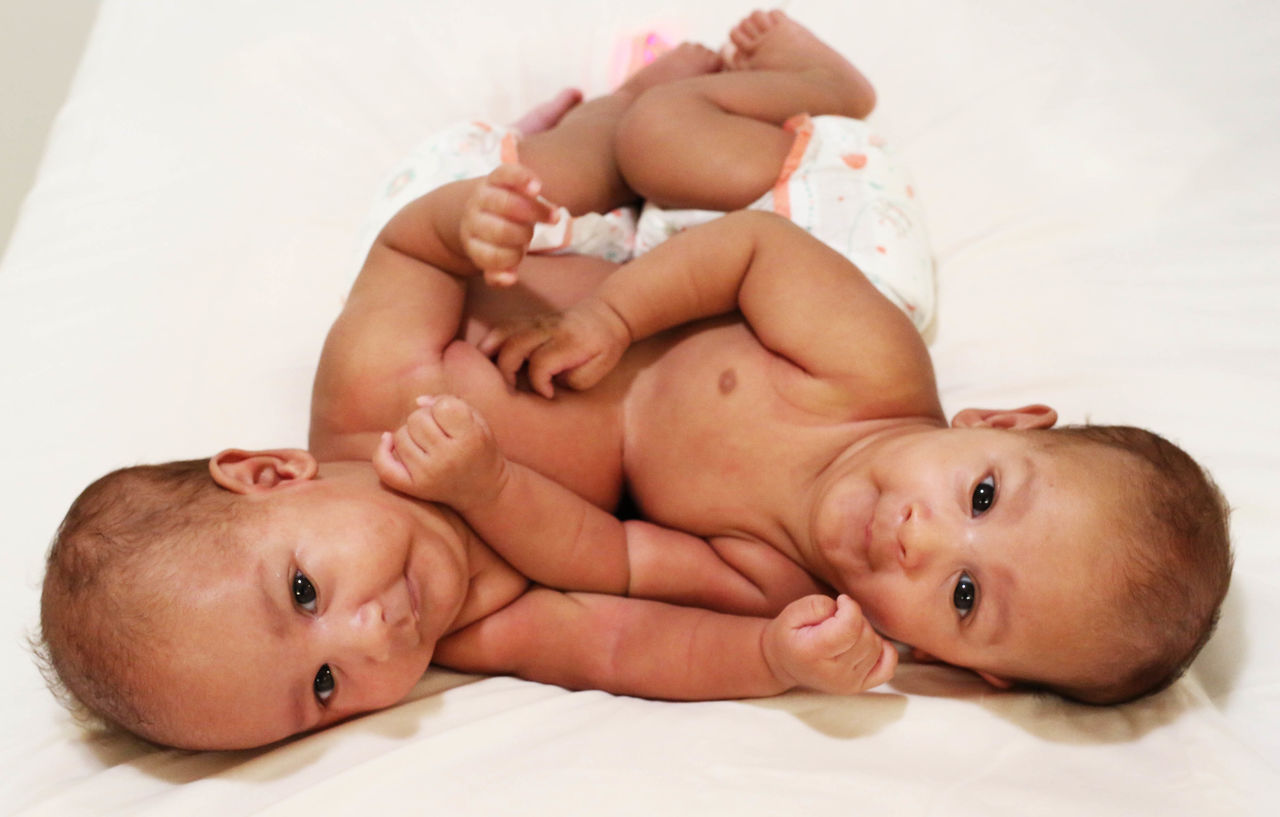 1. Sidra Medicine - Conjoined Twins Tamim Hamad - image courtesy Carl Sulit.jpg